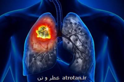 ارتباط آلودگی هوا با افزایش مبتلاشدن به سرطان ریه