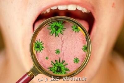 كروناویروس در غدد بزاق دهان تكثیر می شود