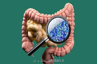 راه های حفظ سلامت مغز وابسته به روده هاست