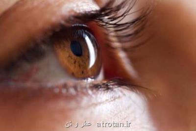 تشخیص اختلال بیش فعالی و اوتیسم بوسیله چشم ها