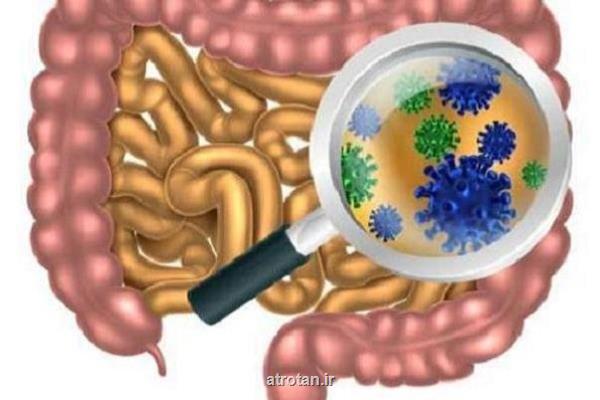 منشاء بیماری آلزایمر در روده هاست