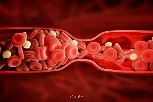 کاهش پلاک های خونی ریسک حمله قلبی را تا 25 درصد کاهش می دهد