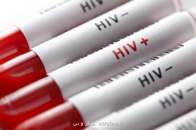 آخرین وضعیت بروز HIV در کشور