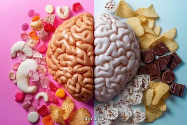 چاقی در مغز شروع می شود!