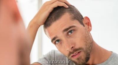 بهترین راه ها برای رطوبت رسانی مو
