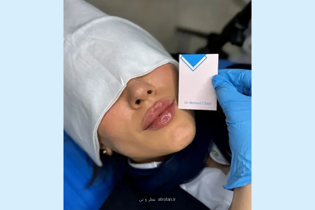 استفاده از فیلر لب چه تاثیری در زیبایی صورت دارد؟