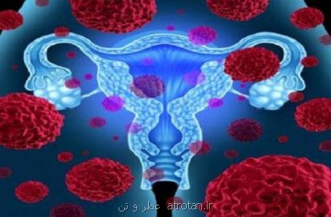 تاثیر قرص های ضدبارداری در مقابله با سرطان تخمدان